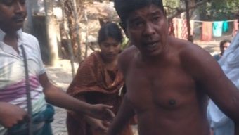 খুলনার পাইকগাছার গড়ইখালীতে জমিজমা সংক্রান্ত আপন ২ ভাই মারামারিতে মেয়ের লাঠির আঘাতে পিতা জখম
