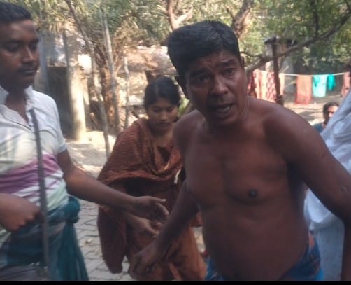 খুলনার পাইকগাছার গড়ইখালীতে জমিজমা সংক্রান্ত আপন ২ ভাই মারামারিতে মেয়ের লাঠির আঘাতে পিতা জখম