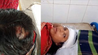 পলাশবাড়ীতে জমি নিয়ে দ্বন্দ্বের জেরে মা-মেয়েকে পিটিয়ে হাসপাতালে পাঠালো প্রতিপক্ষরা,