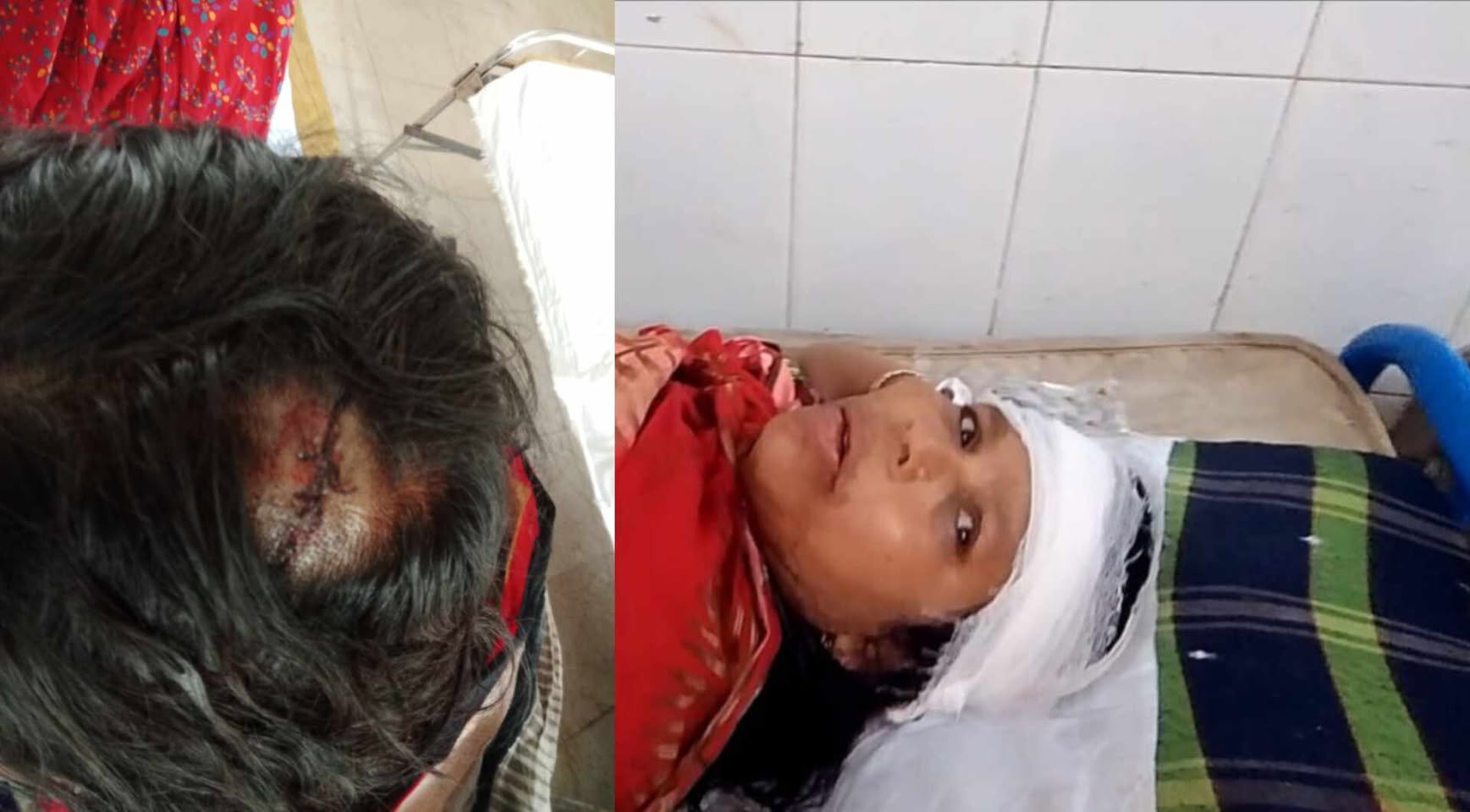 পলাশবাড়ীতে জমি নিয়ে দ্বন্দ্বের জেরে মা-মেয়েকে পিটিয়ে হাসপাতালে পাঠালো প্রতিপক্ষরা,