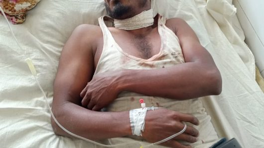 গাছ কাটাকে কেন্দ্র করে ছোট ভাইয়ের কুঠারের আঘাতে আহত বড় ভাই।  ভর্তি হাসপাতালে।